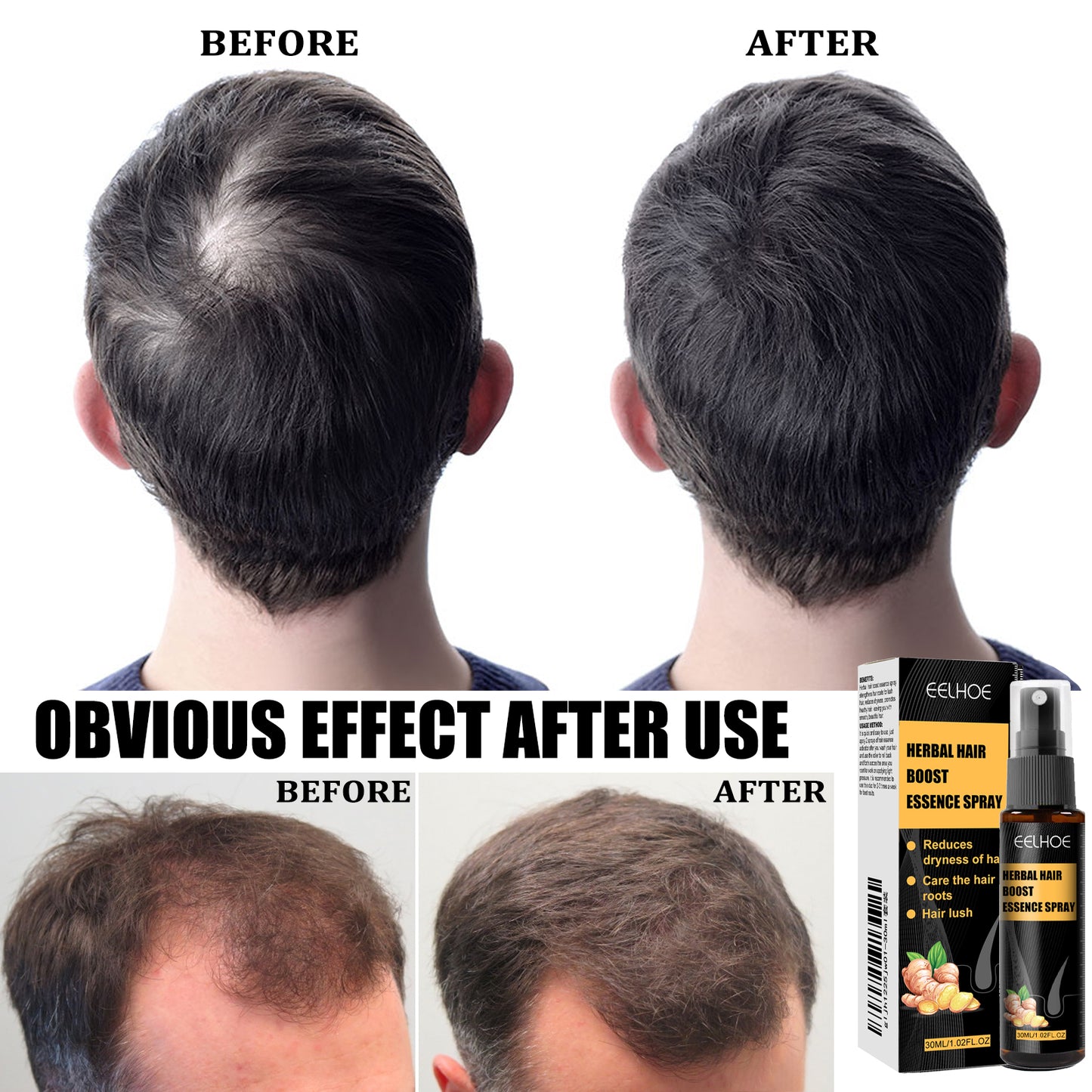 Derma Roller with Herbal Hair Spray